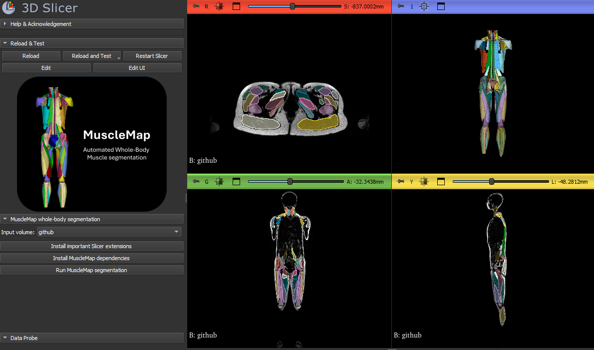 MuscleMap Slicer 3D view
