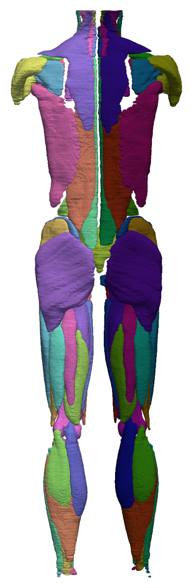 Whole-body MRI muscle segmentation, front view