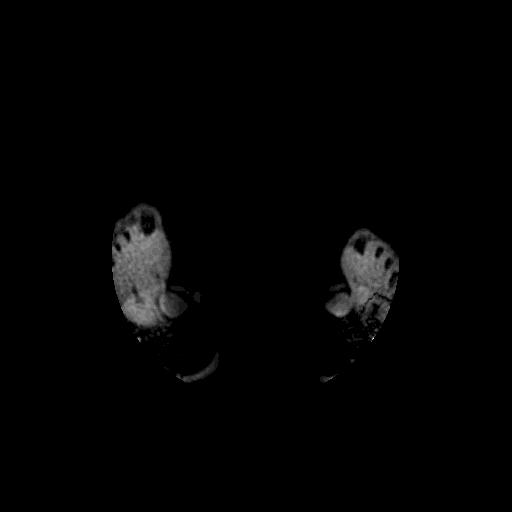 MuscleMap whole-body GIF