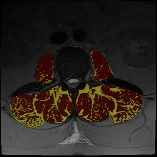 MuscleMap thresholding png