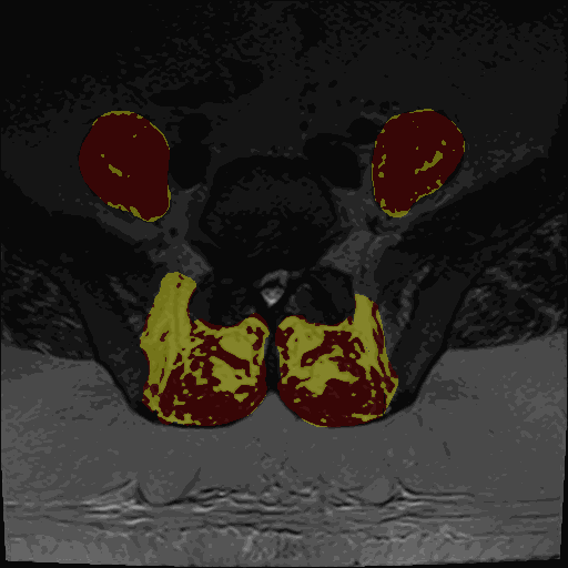 Animated example of MuscleMap muscle quantification